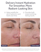 ALASTIN Skincare Hyaluronic Acid HA IMMERSE Moisturizing Face Serum (1 oz) | Restorative Serum Combats Dry, Dehydrated Skin | For Radiant, Glowing Skin