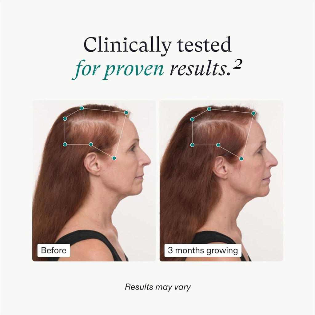 Nutrafol Women’s Balance Hair Growth Supplements – Ages 45+, 1 Month Supply