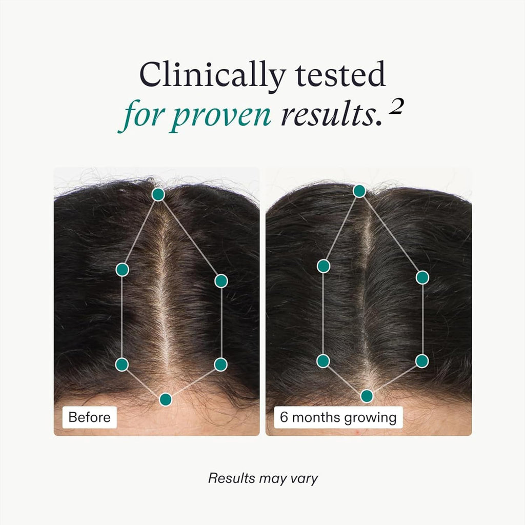 Nutrafol Women’s Hair Growth Supplements – Ages 18-44, 1 Month Supply