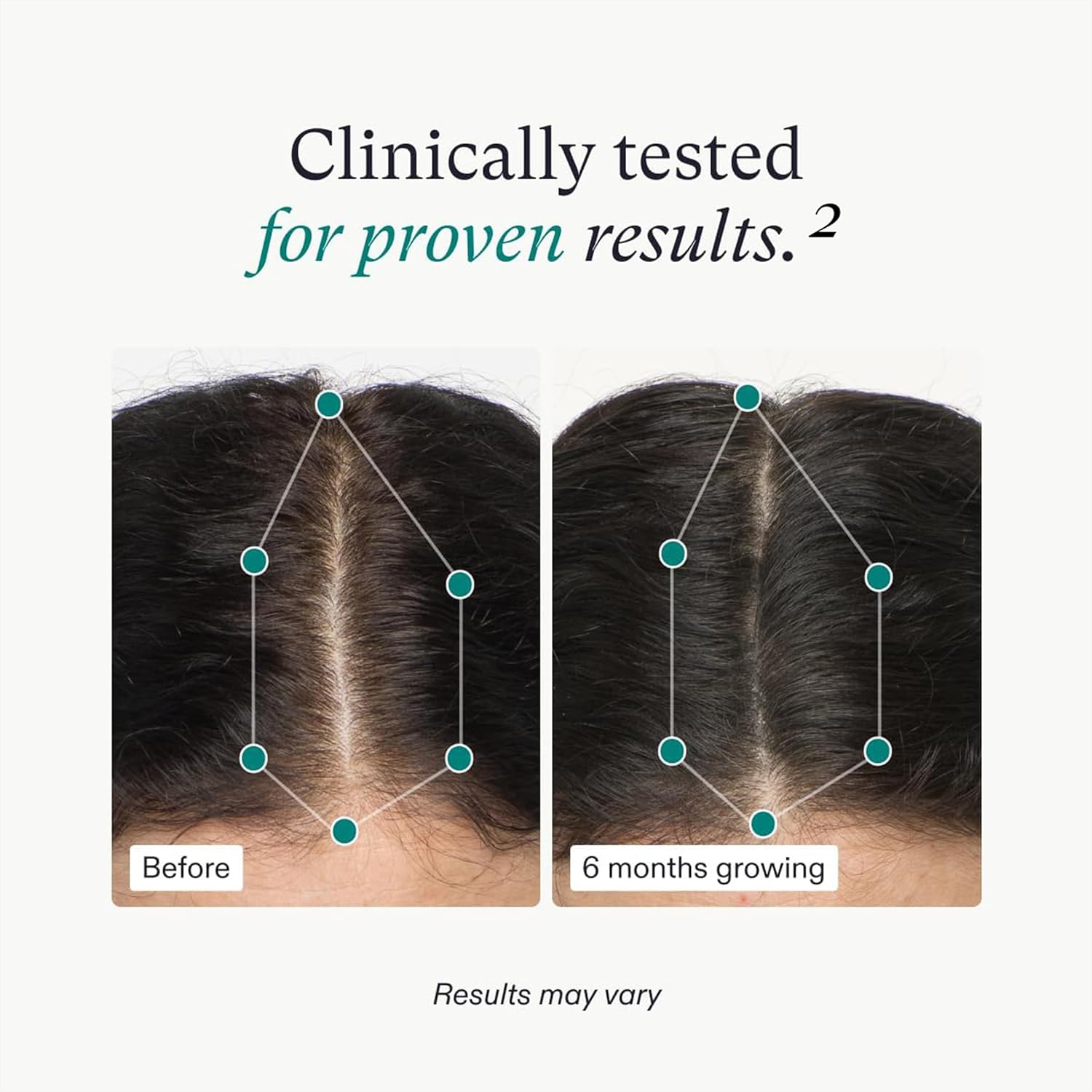 Nutrafol Women’s Hair Growth Supplements – Ages 18-44, 1 Month Supply
