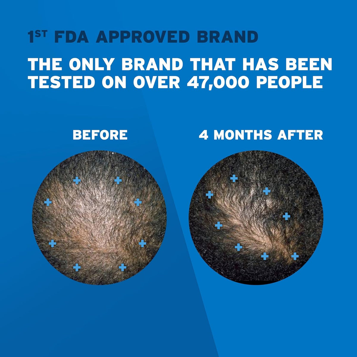 Men's Rogaine 5% Minoxidil Foam for Hair Loss and Hair Regrowth (3-Month Supply) - additional image 5